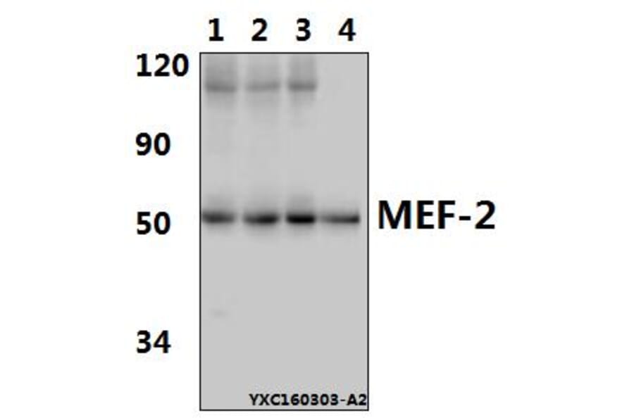Anti-MEF-2 (I402) Antibody from Bioworld Technology (BS1383) - Antibodies.com