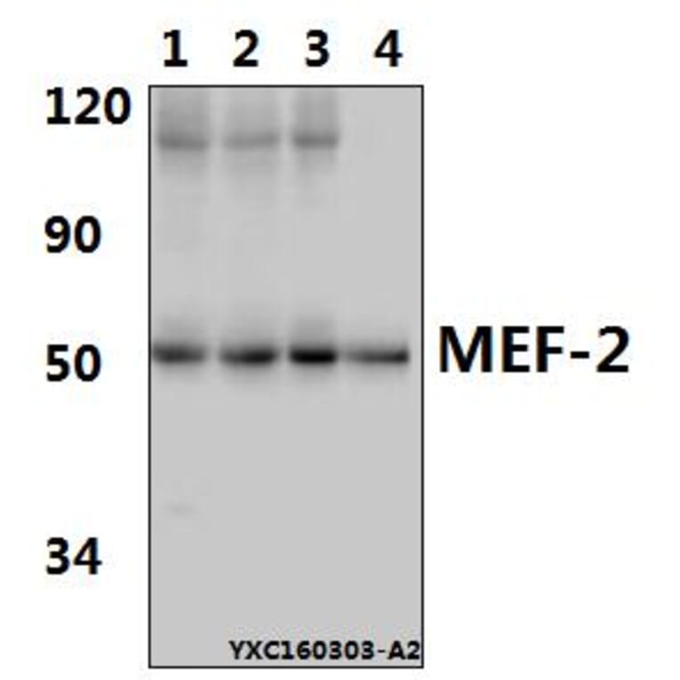 Anti-MEF-2 (I402) Antibody from Bioworld Technology (BS1383) - Antibodies.com