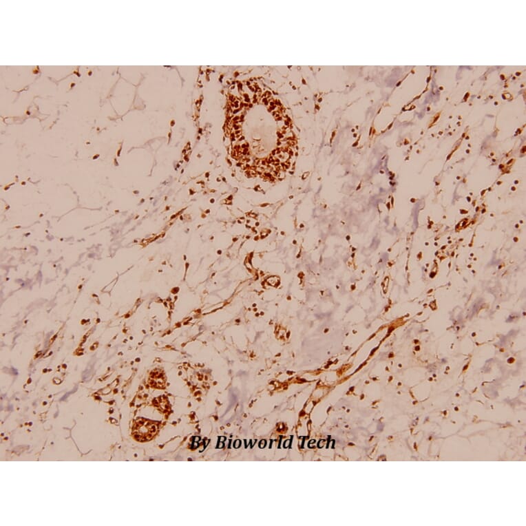 Anti-MEF-2 (I402) Antibody from Bioworld Technology (BS1383) - Antibodies.com