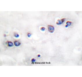 Anti-ND1 Antibody from Bioworld Technology (BS1385) - Antibodies.com