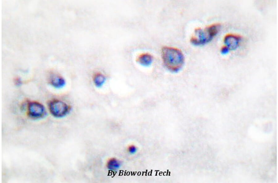 Anti-ND1 Antibody from Bioworld Technology (BS1385) - Antibodies.com
