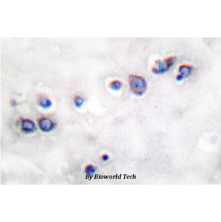 Anti-ND1 Antibody from Bioworld Technology (BS1385) - Antibodies.com