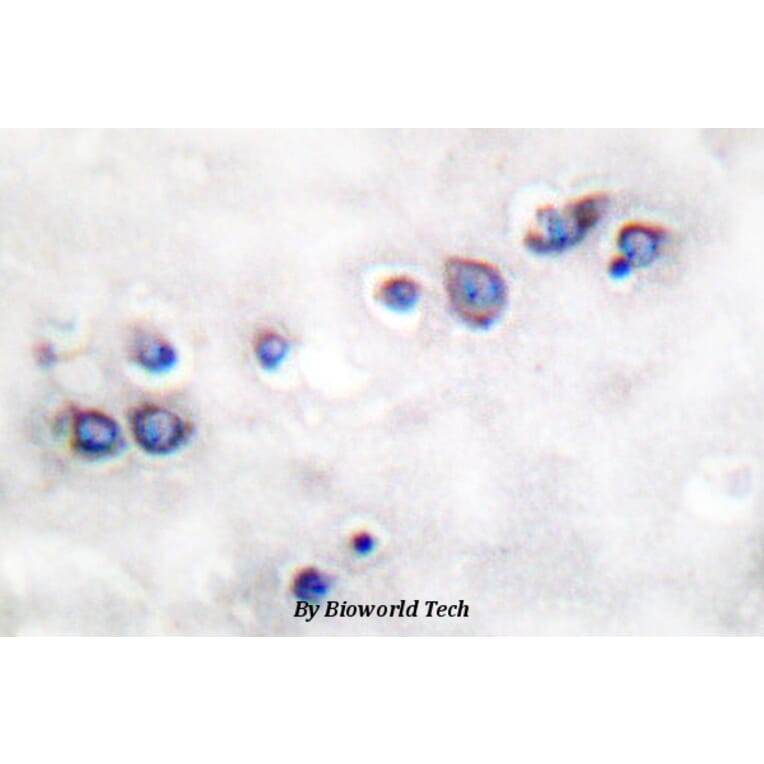 Anti-ND1 Antibody from Bioworld Technology (BS1385) - Antibodies.com