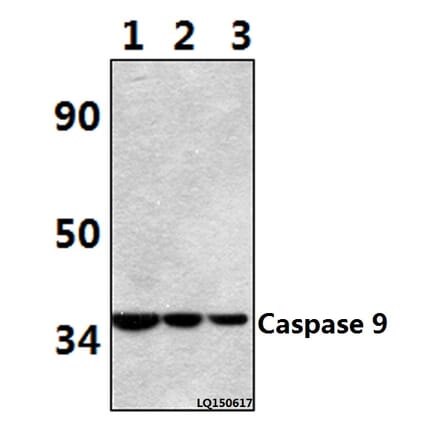 Anti-Caspase 9 (E119) Antibody from Bioworld Technology (BS1388) - Antibodies.com