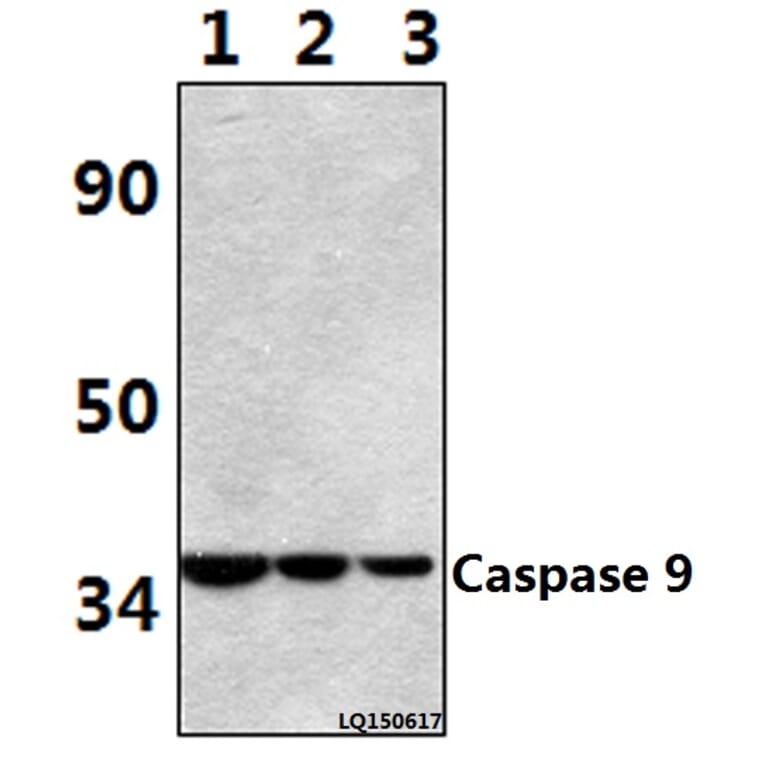 Anti-Caspase 9 (E119) Antibody from Bioworld Technology (BS1388) - Antibodies.com