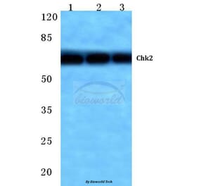 Anti-Chk2 (M381) Antibody from Bioworld Technology (BS1391) - Antibodies.com