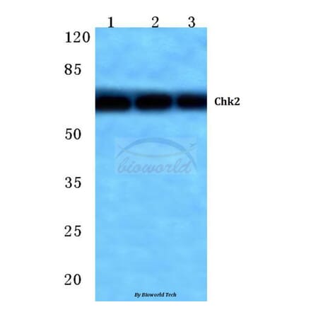Anti-Chk2 (M381) Antibody from Bioworld Technology (BS1391) - Antibodies.com