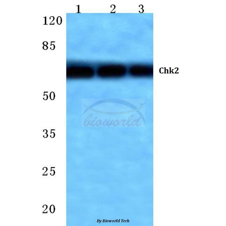 Anti-Chk2 (M381) Antibody from Bioworld Technology (BS1391) - Antibodies.com