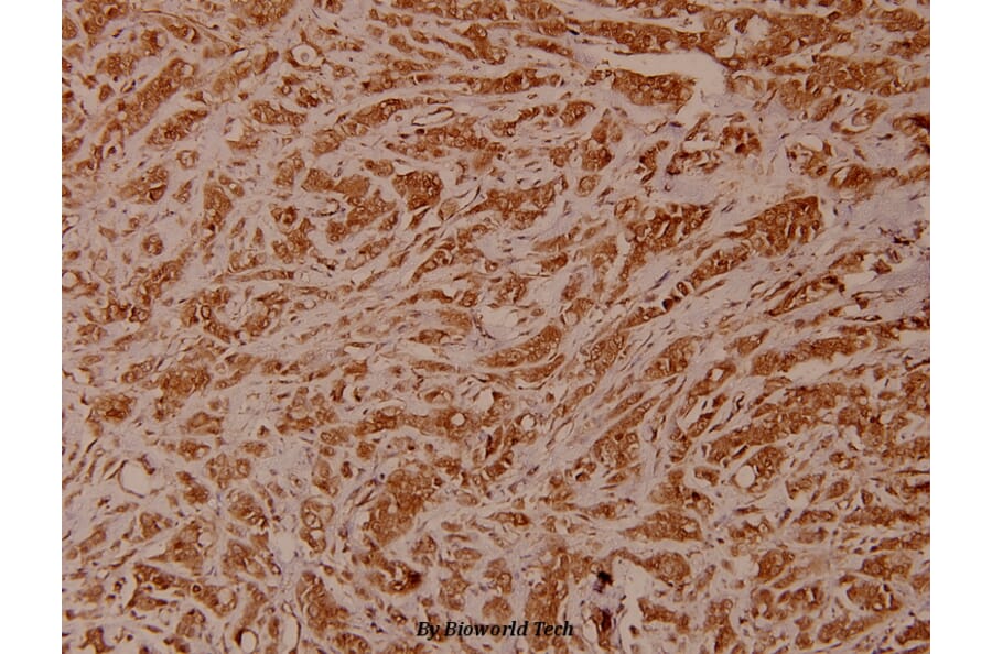 Anti-Chk2 (M381) Antibody from Bioworld Technology (BS1391) - Antibodies.com