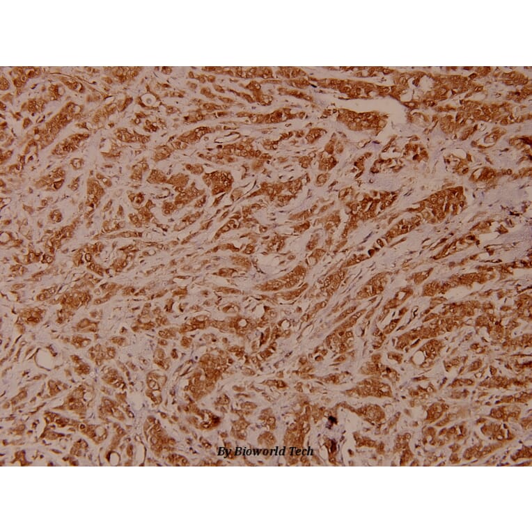 Anti-Chk2 (M381) Antibody from Bioworld Technology (BS1391) - Antibodies.com