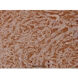 Anti-Chk2 (M381) Antibody from Bioworld Technology (BS1391) - Antibodies.com
