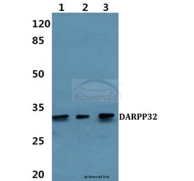 Anti-DARPP-32 (P69) Antibody from Bioworld Technology (BS1394) - Antibodies.com