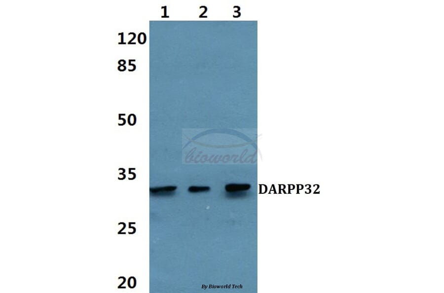Anti-DARPP-32 (P69) Antibody from Bioworld Technology (BS1394) - Antibodies.com