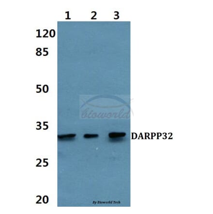 Anti-DARPP-32 (P69) Antibody from Bioworld Technology (BS1394) - Antibodies.com