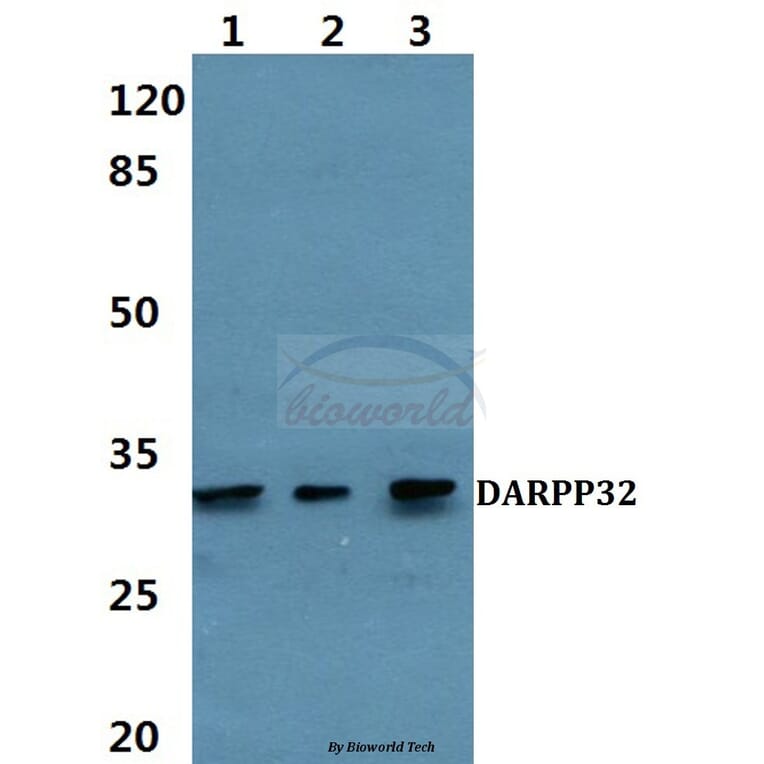 Anti-DARPP-32 (P69) Antibody from Bioworld Technology (BS1394) - Antibodies.com