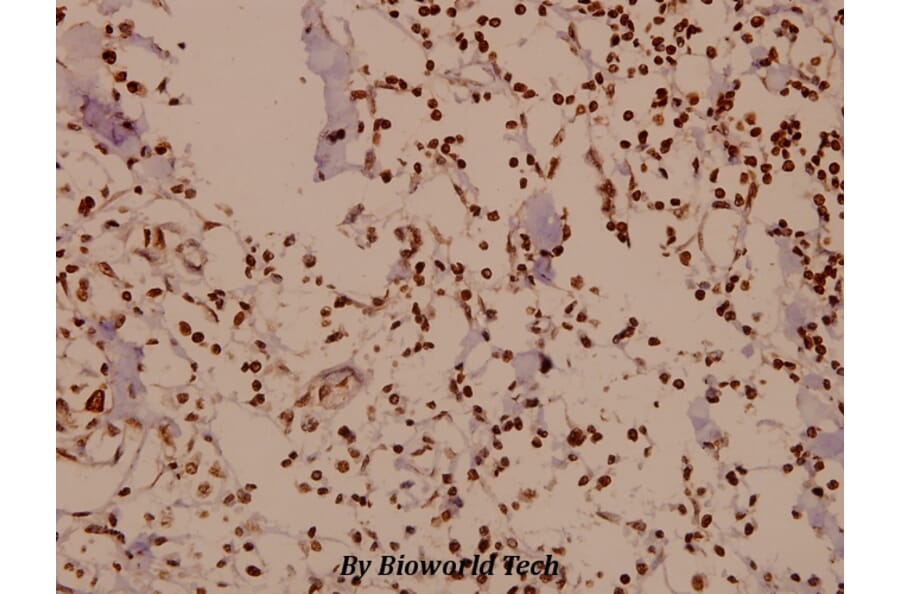 Anti-DARPP-32 (P69) Antibody from Bioworld Technology (BS1394) - Antibodies.com