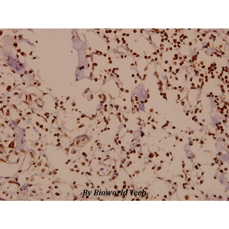 Anti-DARPP-32 (P69) Antibody from Bioworld Technology (BS1394) - Antibodies.com