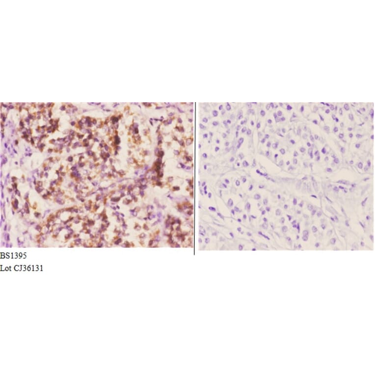 Anti-Daxx (K662) Antibody from Bioworld Technology (BS1395) - Antibodies.com