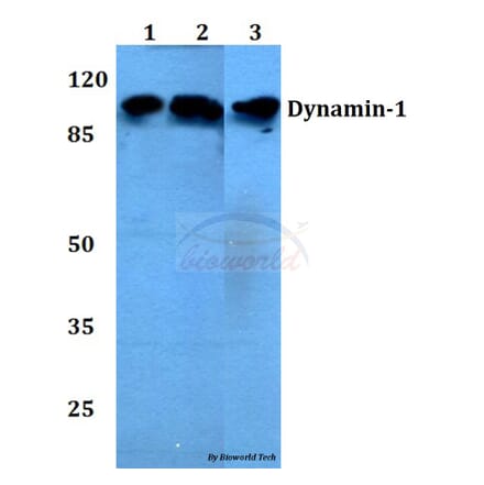 Dynamin 1 Antibodies + 