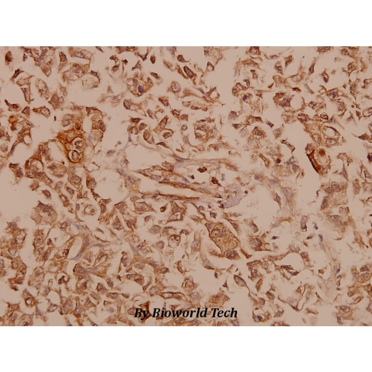 Anti-Dynamin-1 (V768) Antibody from Bioworld Technology (BS1396) - Antibodies.com