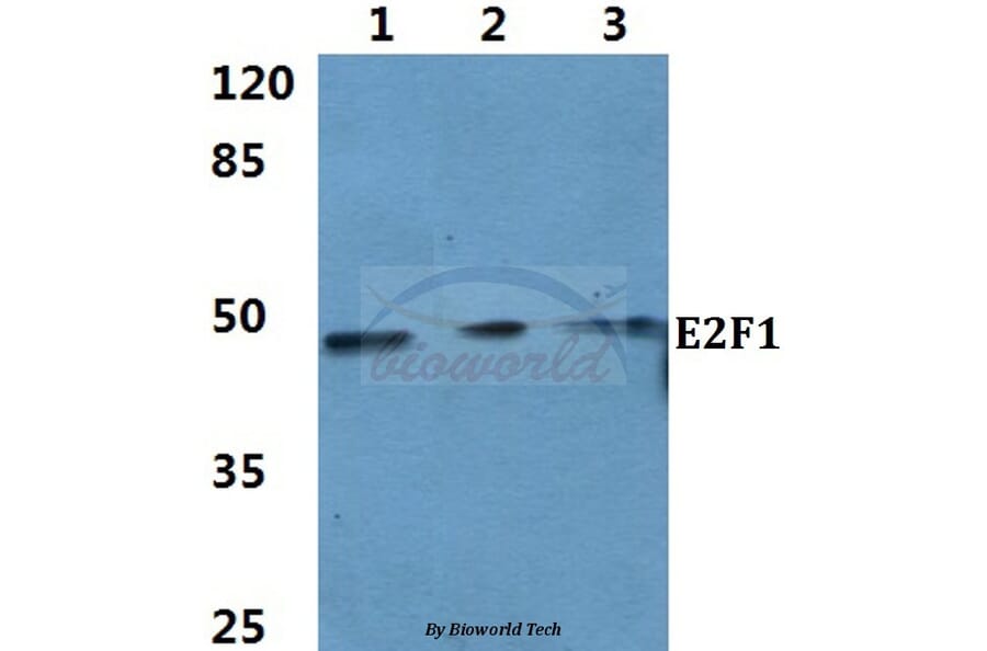 Anti-E2F-1 (D426) Antibody from Bioworld Technology (BS1397) - Antibodies.com