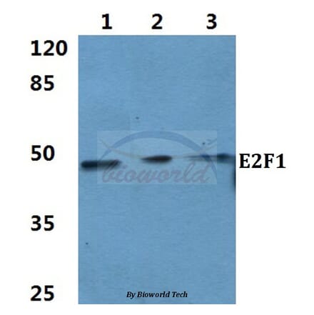 Anti-E2F-1 (D426) Antibody from Bioworld Technology (BS1397) - Antibodies.com