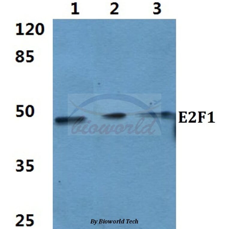 Anti-E2F-1 (D426) Antibody from Bioworld Technology (BS1397) - Antibodies.com