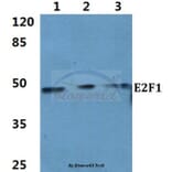 Anti-E2F-1 (D426) Antibody from Bioworld Technology (BS1397) - Antibodies.com