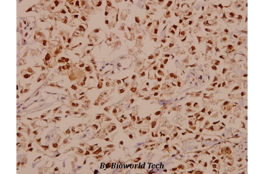 Anti-E2F-1 (D426) Antibody from Bioworld Technology (BS1397) - Antibodies.com