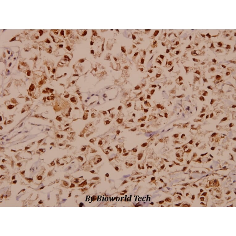 Anti-E2F-1 (D426) Antibody from Bioworld Technology (BS1397) - Antibodies.com
