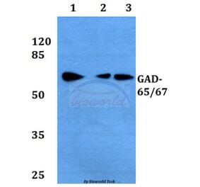 Anti-GAD-65/67 (D572) Antibody from Bioworld Technology (BS1400) - Antibodies.com