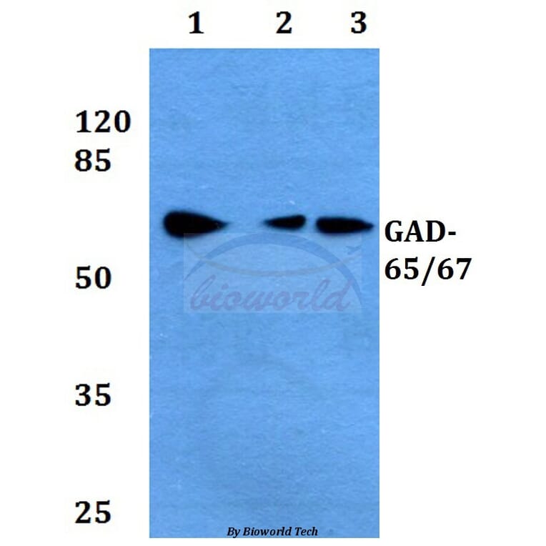 Anti-GAD-65/67 (D572) Antibody from Bioworld Technology (BS1400) - Antibodies.com