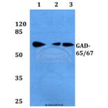 Anti-GAD-65/67 (D572) Antibody from Bioworld Technology (BS1400) - Antibodies.com
