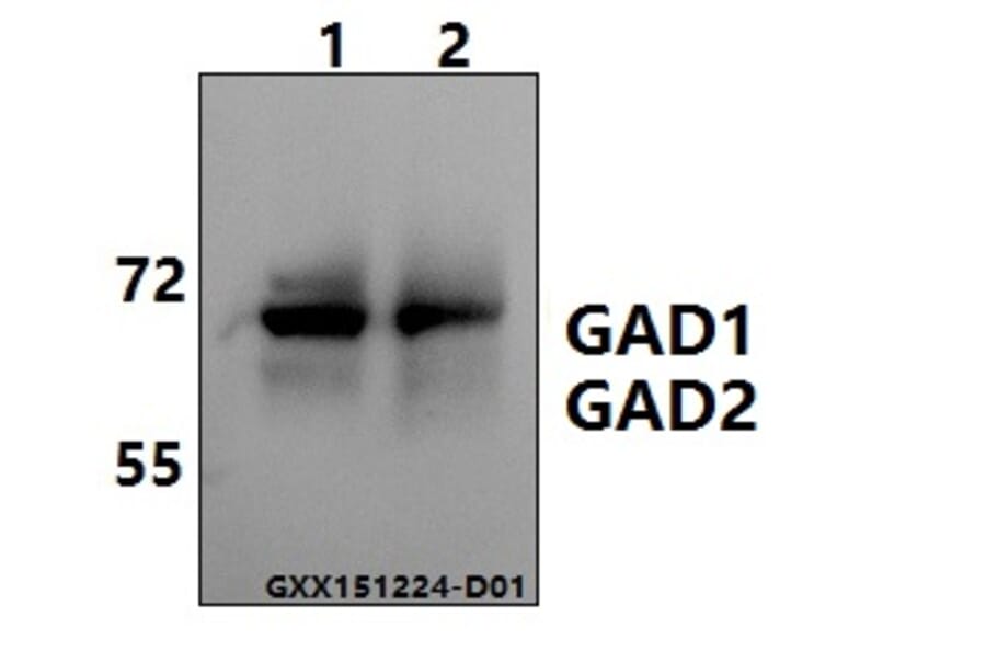 Anti-GAD-65/67 (D572) Antibody from Bioworld Technology (BS1400) - Antibodies.com