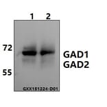 Anti-GAD-65/67 (D572) Antibody from Bioworld Technology (BS1400) - Antibodies.com