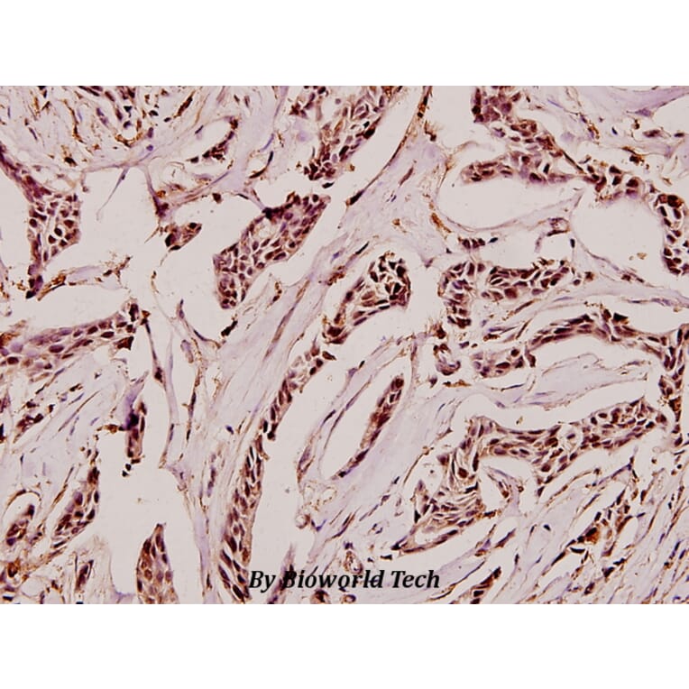 Anti-GAD-65/67 (D572) Antibody from Bioworld Technology (BS1400) - Antibodies.com