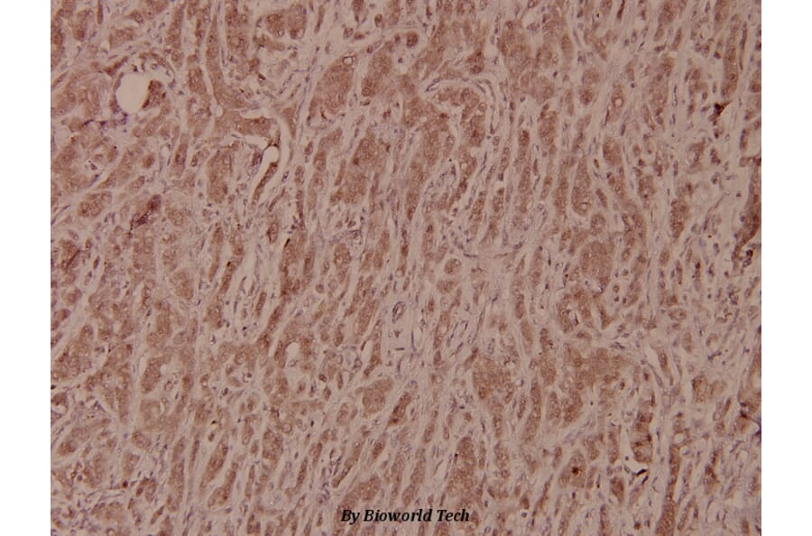 Anti-GSK3β (S2) Antibody from Bioworld Technology (BS1402) - Antibodies.com