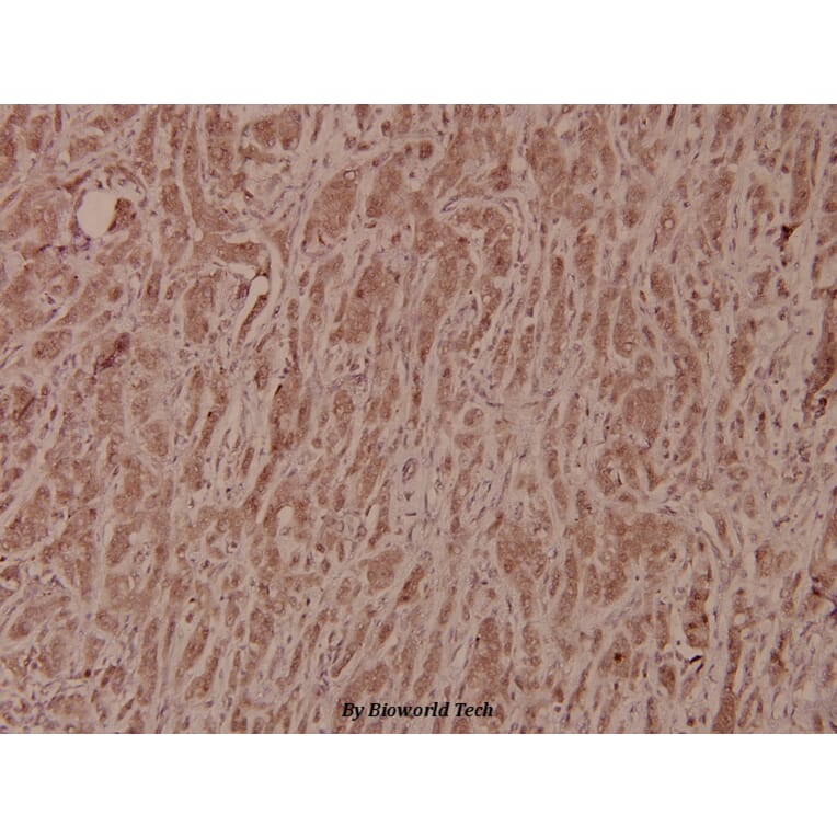 Anti-GSK3β (S2) Antibody from Bioworld Technology (BS1402) - Antibodies.com