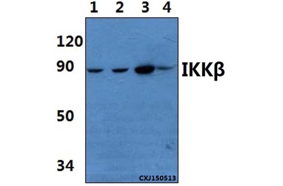 Anti-IKKβ (F182) Antibody from Bioworld Technology (BS1407) - Antibodies.com