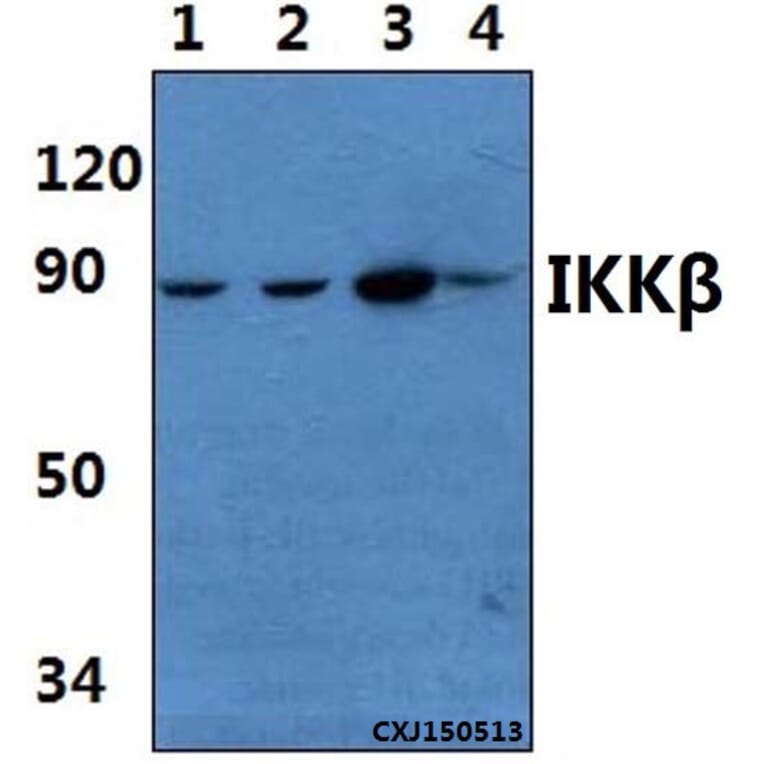 Anti-IKKβ (F182) Antibody from Bioworld Technology (BS1407) - Antibodies.com