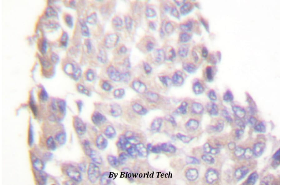 Anti-IKKβ (F182) Antibody from Bioworld Technology (BS1407) - Antibodies.com