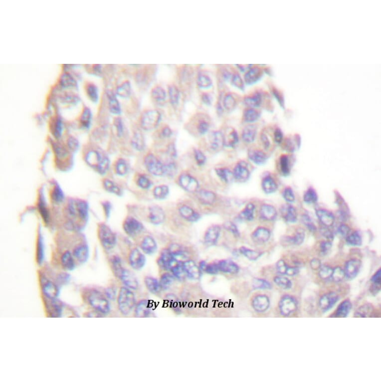 Anti-IKKβ (F182) Antibody from Bioworld Technology (BS1407) - Antibodies.com