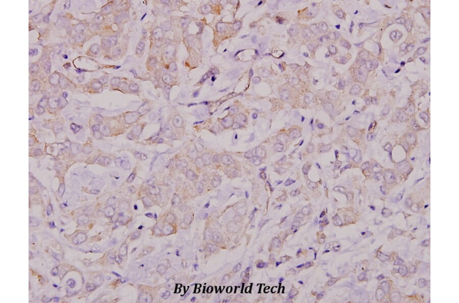 Anti-Lyn (T501) Antibody from Bioworld Technology (BS1410) - Antibodies.com