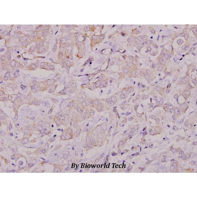 Anti-Lyn (T501) Antibody from Bioworld Technology (BS1410) - Antibodies.com