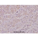 Anti-Lyn (T501) Antibody from Bioworld Technology (BS1410) - Antibodies.com