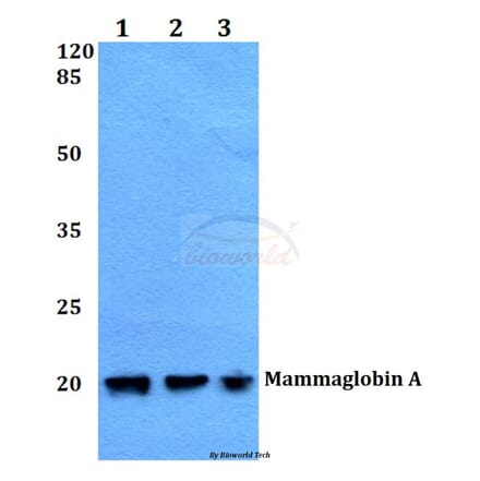 Anti-Mammaglobin A (F66) Antibody from Bioworld Technology (BS1411) - Antibodies.com