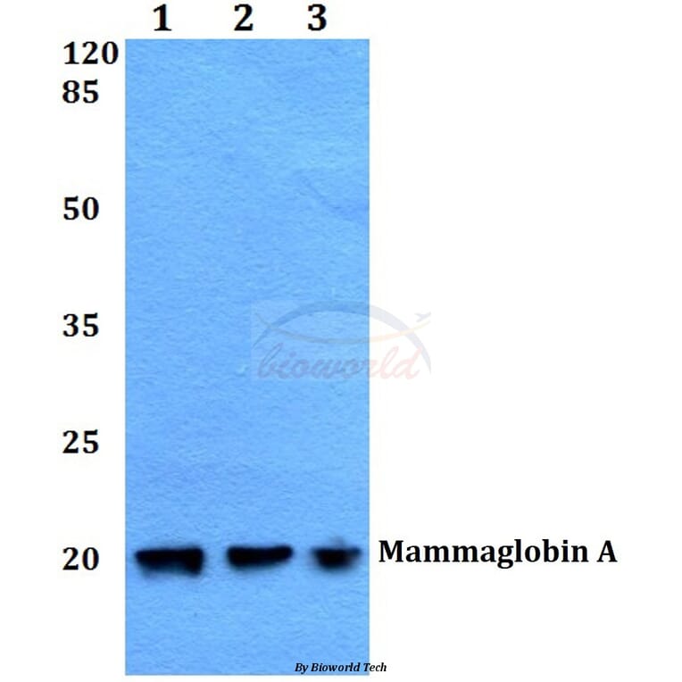 Anti-Mammaglobin A (F66) Antibody from Bioworld Technology (BS1411) - Antibodies.com