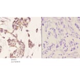 Anti-Mammaglobin A (F66) Antibody from Bioworld Technology (BS1411) - Antibodies.com