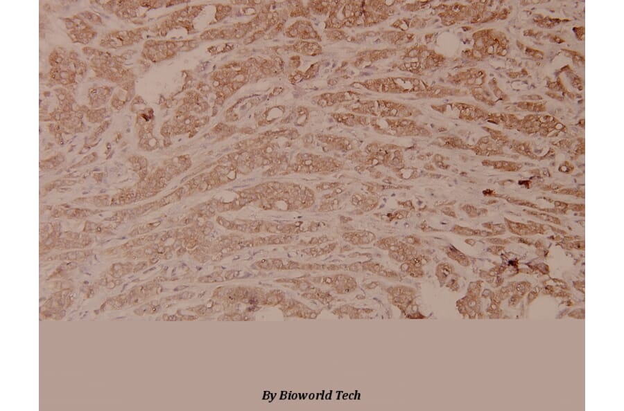 Anti-GSK3α/β (G273) Antibody from Bioworld Technology (BS1412) - Antibodies.com