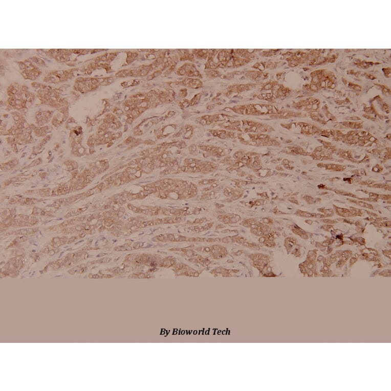 Anti-GSK3α/β (G273) Antibody from Bioworld Technology (BS1412) - Antibodies.com